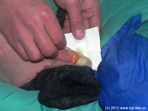 12. 4. 2012 Propichování není dobrý nápad