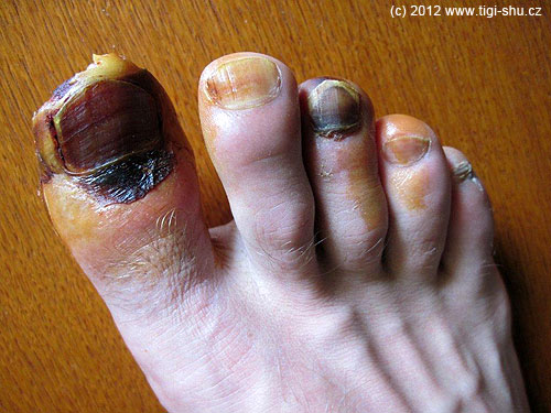 7. 5. 2012 Začíná silné černání