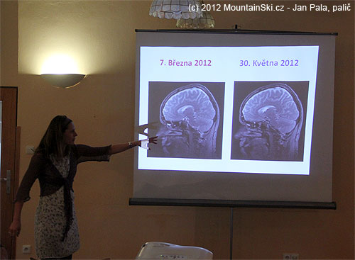 MRI před expedicí a po expedici – rozdíl žádný!