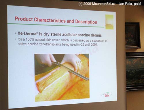 S popáleninami či omrzlinami si Xe-Derma poradí